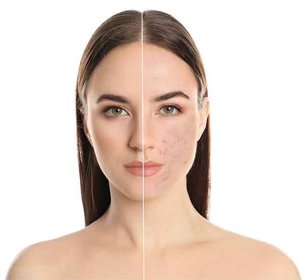 Hero image of laser scar treatment at Vive Laser Center Tijuana, highlighting advanced technology used to reduce the appearance of scars and improve skin texture.