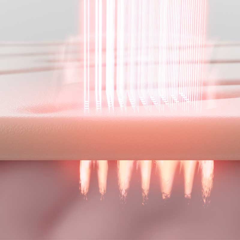 Fractional CO2 laser scar treatment at Vive Laser Center Tijuana, targeting skin imperfections with precision to promote collagen production and smoother texture.