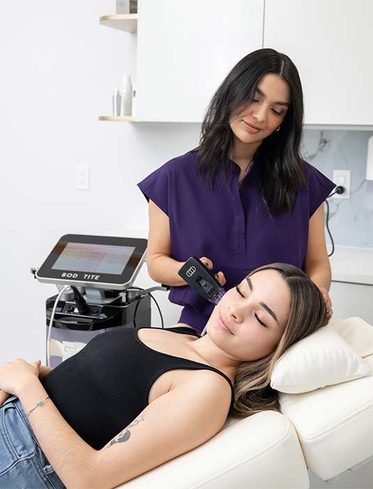 Patient undergoing Morpheus8 treatment at Vive Laser Center Tijuana, receiving advanced microneedling and radiofrequency therapy for skin tightening and rejuvenation.