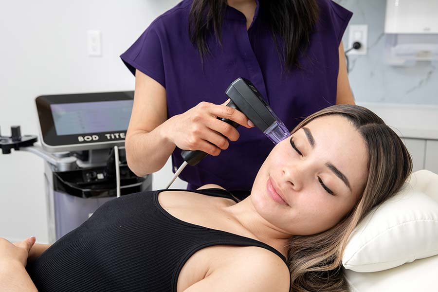 Patient receiving Morpheus8 facial treatment at Vive Laser Center Tijuana, targeting skin tightening, wrinkle reduction, and overall rejuvenation with microneedling and radiofrequency technology.
