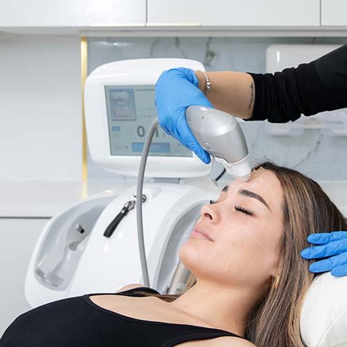 Patient receiving Ultraformer III facial treatment at Vive Laser Center Tijuana, targeting skin lifting, tightening, and collagen stimulation with advanced HIFU technology.